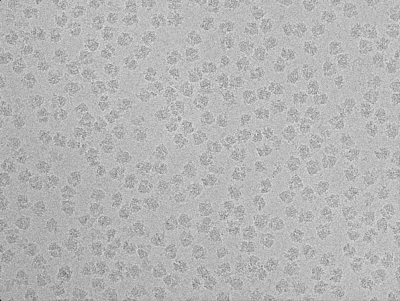 ribosome_micrograph.png